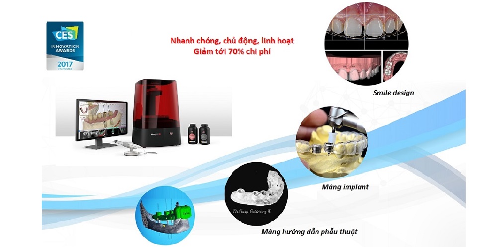 Sử dụng máy in 3D trong nha khoa